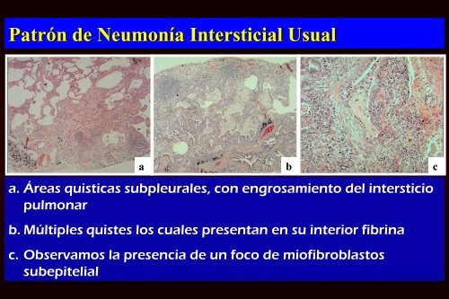 Ver plática - Sociedad Mexicana de Neumología y Cirugía de Tórax