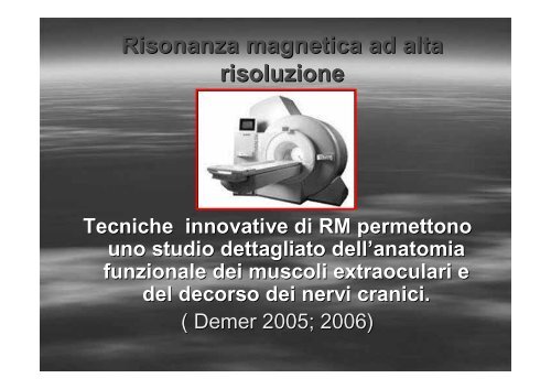 Fibrosi congenita dei muscoli extraoculari - E. Medea