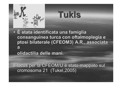 Fibrosi congenita dei muscoli extraoculari - E. Medea