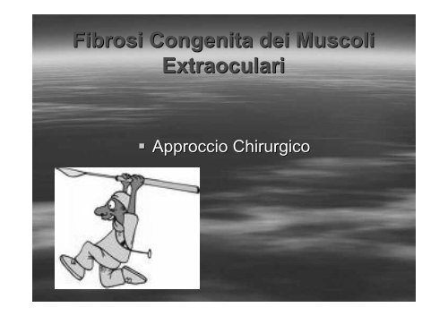 Fibrosi congenita dei muscoli extraoculari - E. Medea