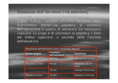 Fibrosi congenita dei muscoli extraoculari - E. Medea