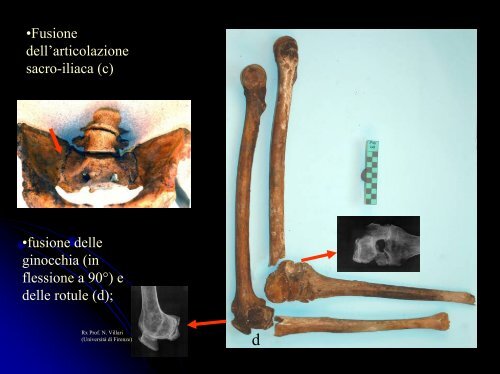 scarica la presentazione - Paleopatologia