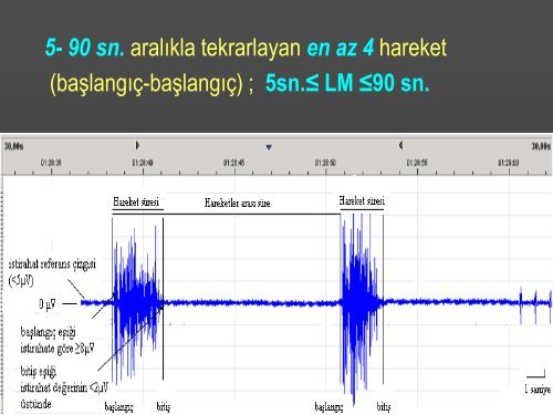 UYKUDA PERİYODİK EKSTREMİTE HAREKETLERİ SKORLAMASI