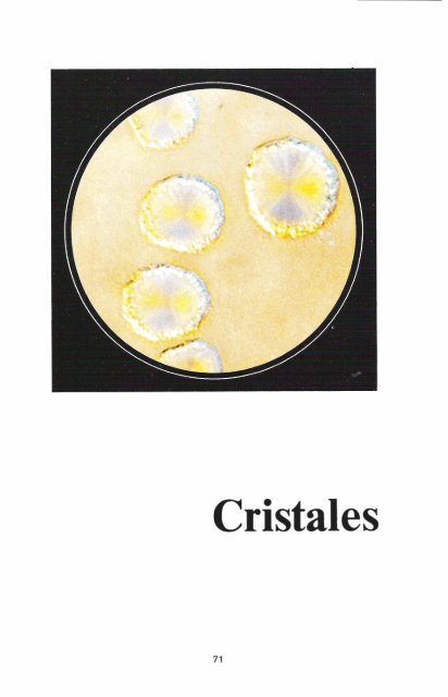 En acidas y orinas alcalinas cristales