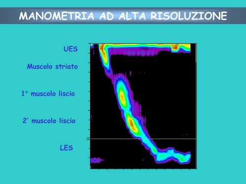 Manometria ad Alta Risoluzione - Gismad