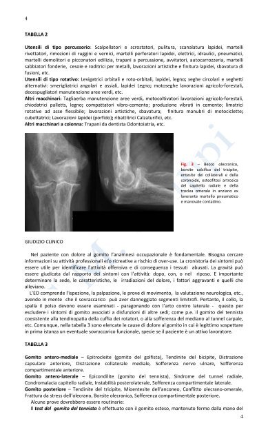 Over-use del gomito e Fasciotomia Tricompartimentale pdf