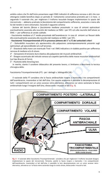 Over-use del gomito e Fasciotomia Tricompartimentale pdf