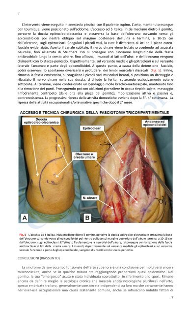 Over-use del gomito e Fasciotomia Tricompartimentale pdf