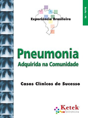 Casos Clínicos de Sucesso - Recife - PE - Medical Services
