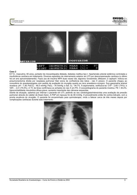 Avaliação Pré-Anestésica em Paciente com Pneumopatia