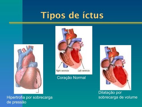 Exame clínico do aparelho cardiovascular - UFF