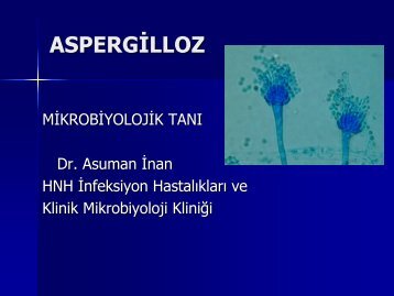 Aspergilloz: Yeni Gelişmeler - Klimik