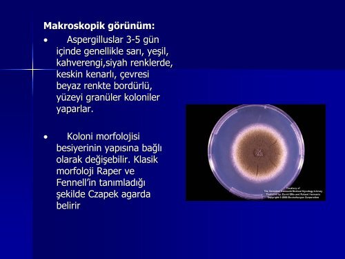 Aspergilloz: Yeni Gelişmeler - Klimik