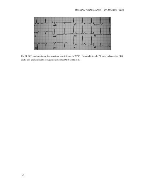 1 II. Fisiopatología A. Mecanismos Generales de las Arritmias ...