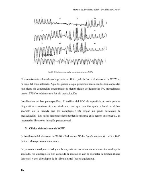 1 II. Fisiopatología A. Mecanismos Generales de las Arritmias ...