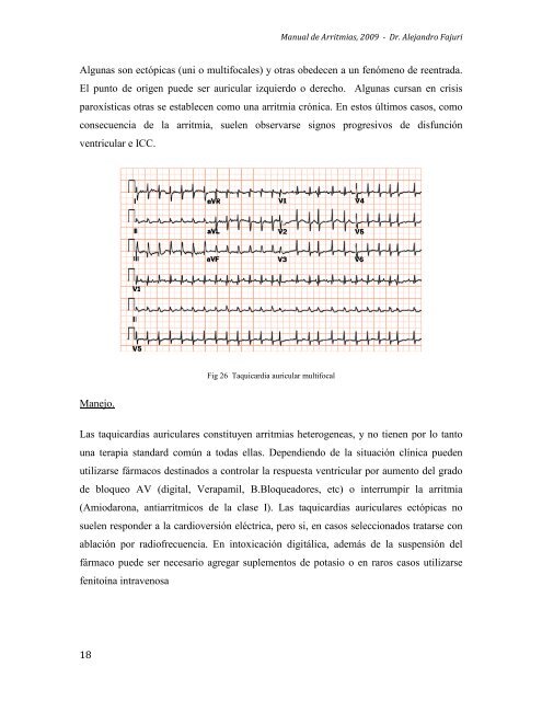 1 II. Fisiopatología A. Mecanismos Generales de las Arritmias ...