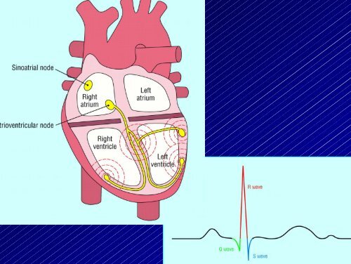 Le aritmie cardiache - Cuorediverona.it