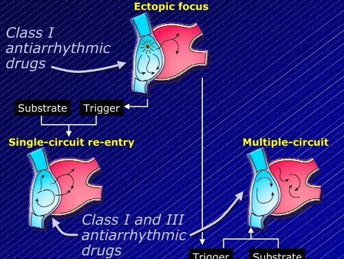 Le aritmie cardiache - Cuorediverona.it