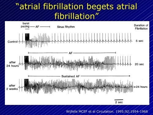 Le aritmie cardiache - Cuorediverona.it