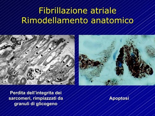 Le aritmie cardiache - Cuorediverona.it