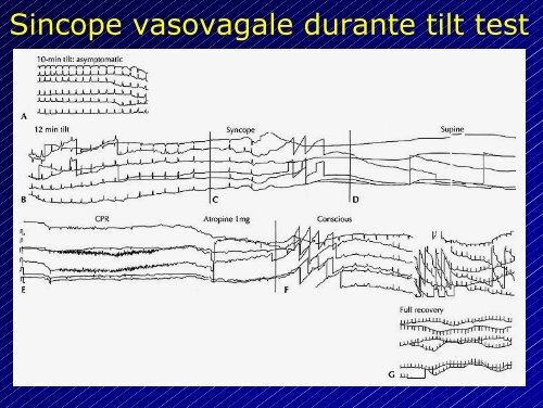 Le aritmie cardiache - Cuorediverona.it