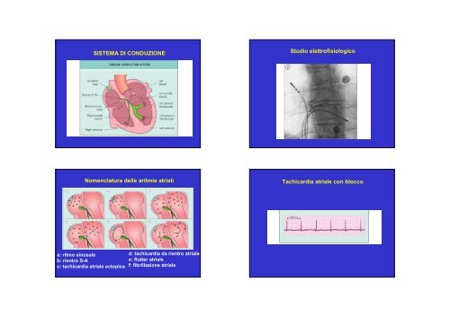 SISTEMA DI CONDUZIONE Studio elettrofisiologico Nomenclatura ...