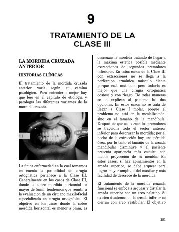 LA MORDIDA CRUZADA ANTERIOR