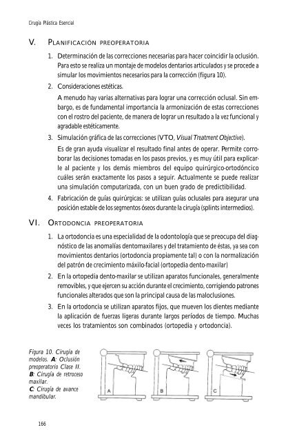 Cirugía ortognática