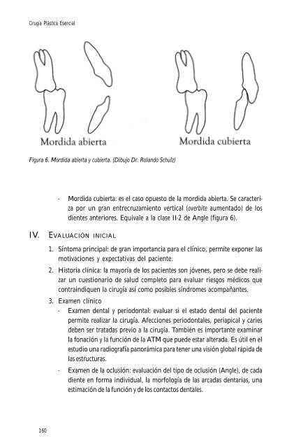 Cirugía ortognática