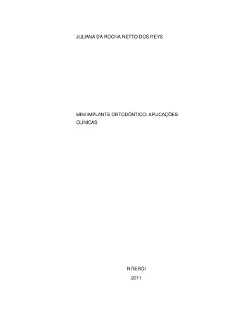 juliana da rocha netto dos reys mini-implante ortodôntico