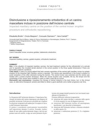 Disinclusione e riposizionamento ortodontico di un canino ...