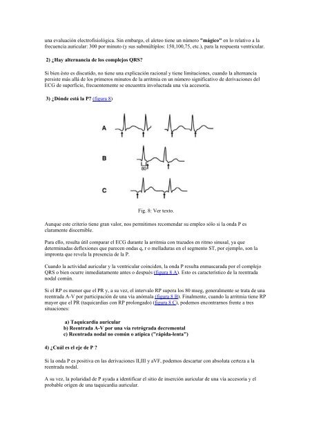 Curso arritmias - G. Zuelgaray: Taquicardias Supraventriculares