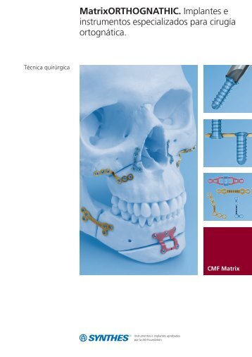 MatrixORTHOGNATHIC Técnica quirúrgica - Synthes