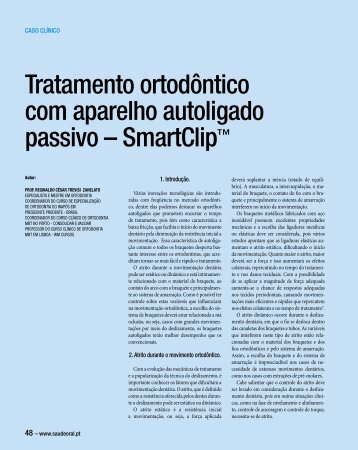 Tratamento ortodôntico com aparelho autoligado passivo ...