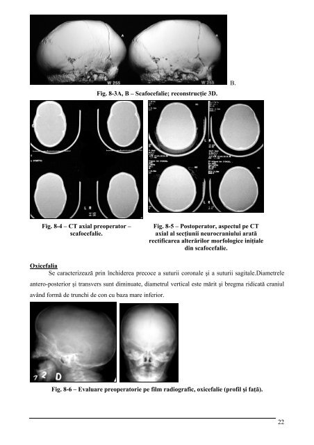 teză de doctorat - Universitatea de Medicina si Farmacie "Carol ...