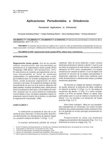 Aplicaciones Periodontales a Ortodoncia - SciELO