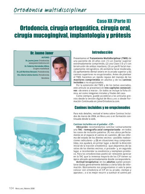 de una paciente de 24 años con: (1) - Ortodoncia Invisible Adultos