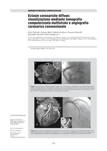 Ectasie coronariche diffuse - Giornale Italiano di Cardiologia