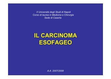 carcinoma dell'esofago - CircolodegliUniversitari