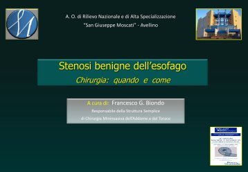 Stenosi benigne dell'esofago - Francescobiondo.It