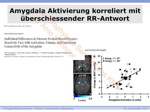 3. Prophylaxe-Seminar des KNS © Arno Villringer - Kompetenznetz ...