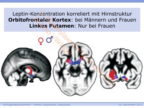 3. Prophylaxe-Seminar des KNS © Arno Villringer - Kompetenznetz ...