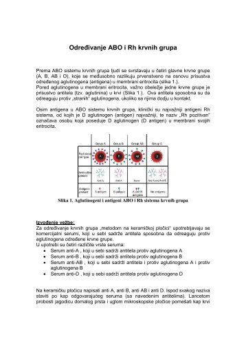 Određivanje ABO i Rh krvnih grupa