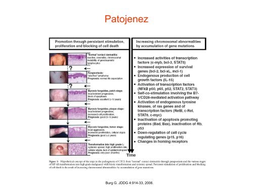 Yavaş Seyirli Cilt Lenfomaları - Lenfoma Myeloma Derneği