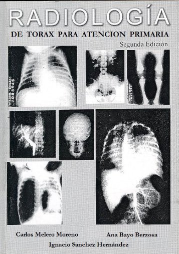 Radiologia-de-Torax-para-Atencion-Primaria