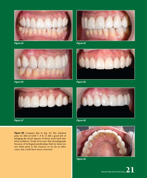 Chairside - Glidewell Dental Labs