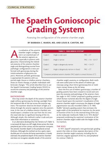 The Spaeth Gonioscopic Grading System - Glaucoma Today