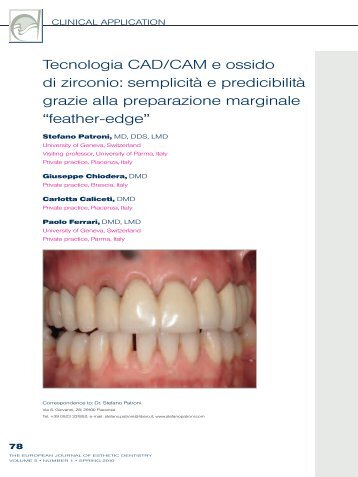 scarica l'articolo in italiano - Stefano Patroni - Studio dentistico