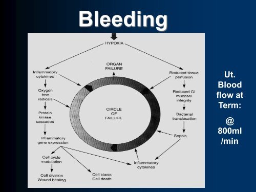 Massive Obstetric Hemorrhage - Health Research at Fernandez ...