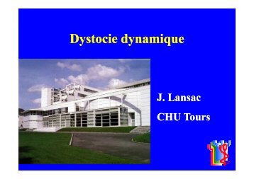 Dystocie dynamique